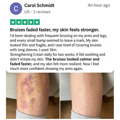 🔥89K+SOLD🔥  Skin Strengthening Cream🎉Limited-time discount