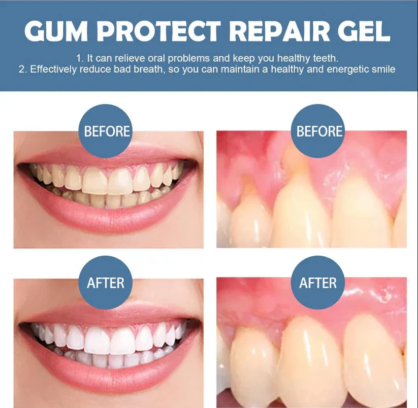 Teeth Repair Gel