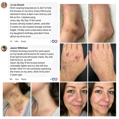 🔥89K+SOLD🔥  Skin Strengthening Cream🎉Limited-time discount